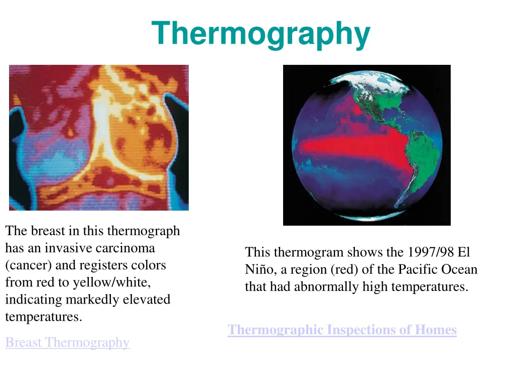 thermography