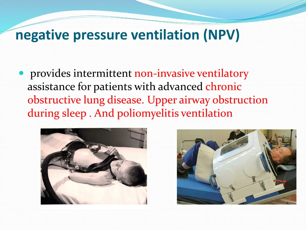 negative pressure ventilation npv