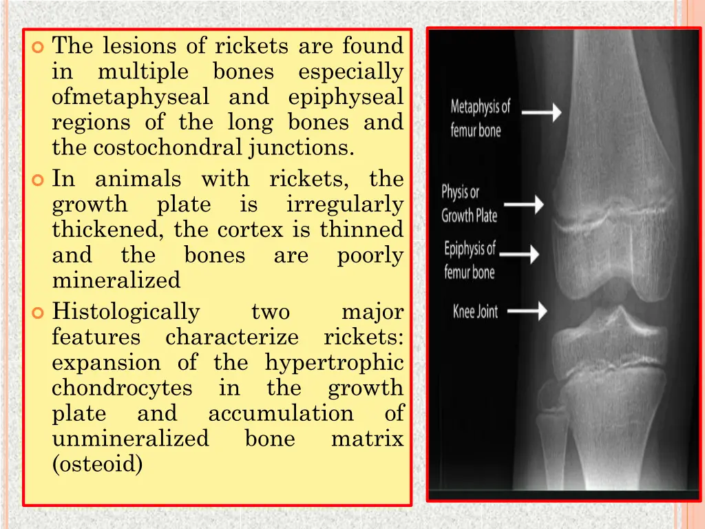 the lesions of rickets are found in multiple