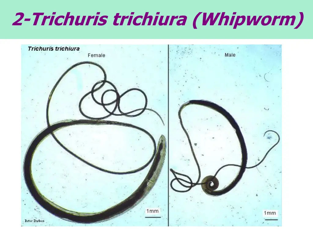 2 trichuris trichiura whipworm