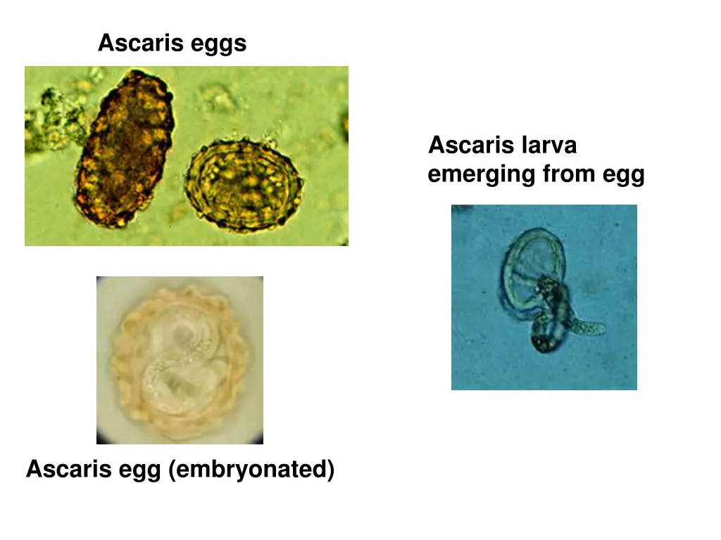 ascaris eggs