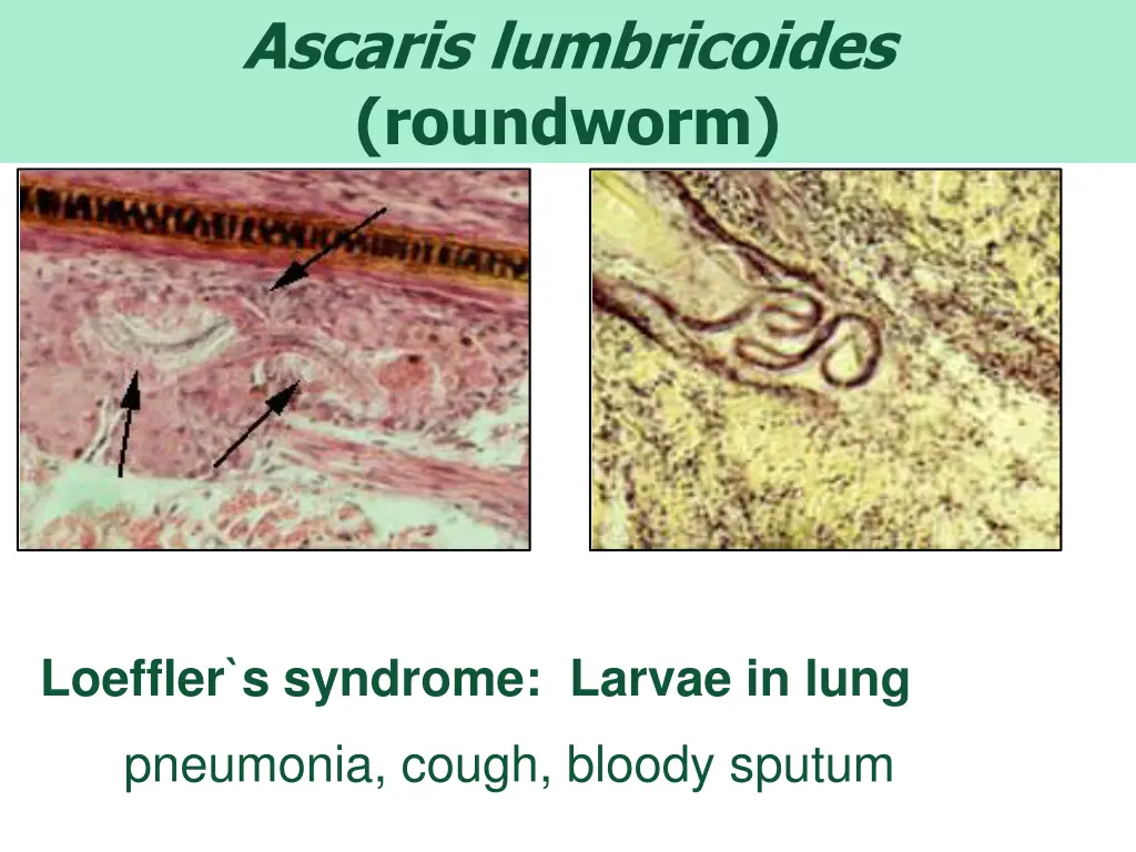 ascaris lumbricoides roundworm 4