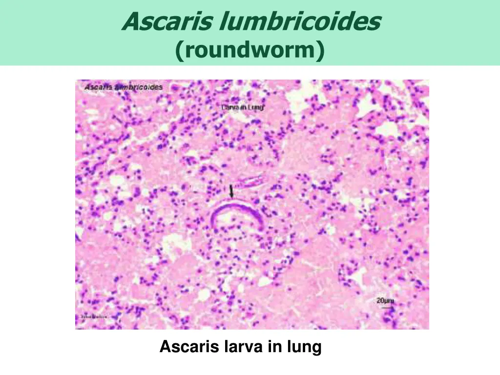 ascaris lumbricoides roundworm 5