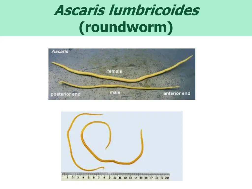 ascaris lumbricoides roundworm