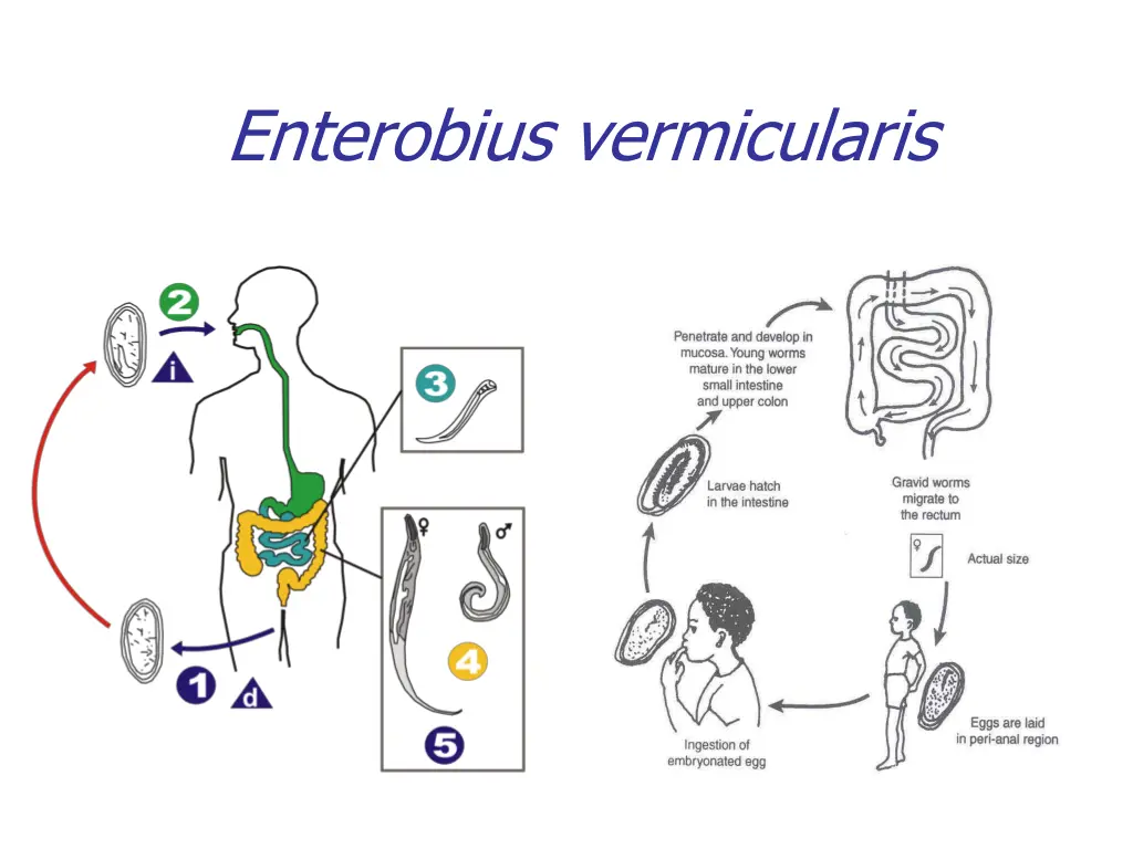 enterobius vermicularis