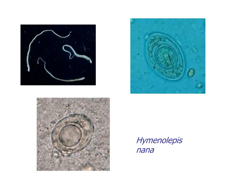 hymenolepis nana 1