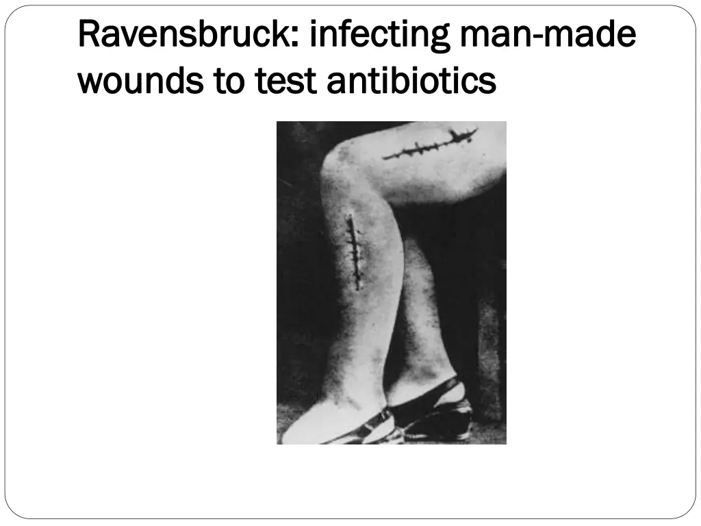 ravensbruck infecting man ravensbruck infecting