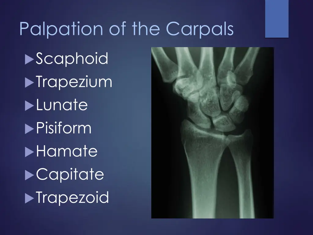 palpation of the carpals