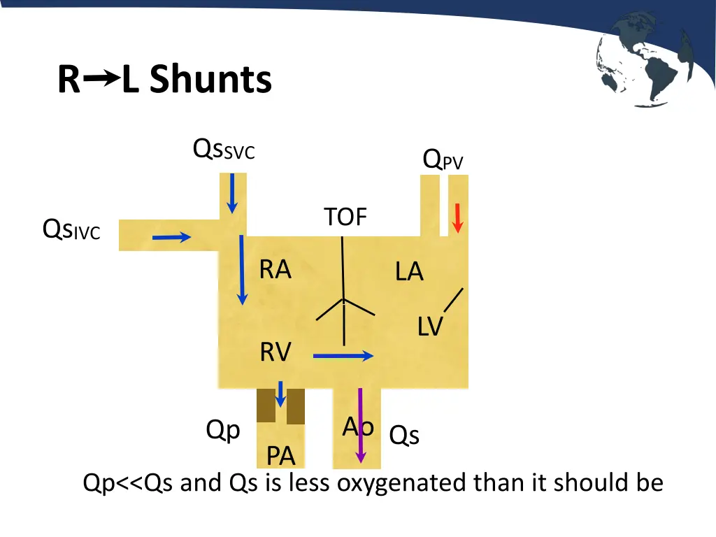 r l shunts 1