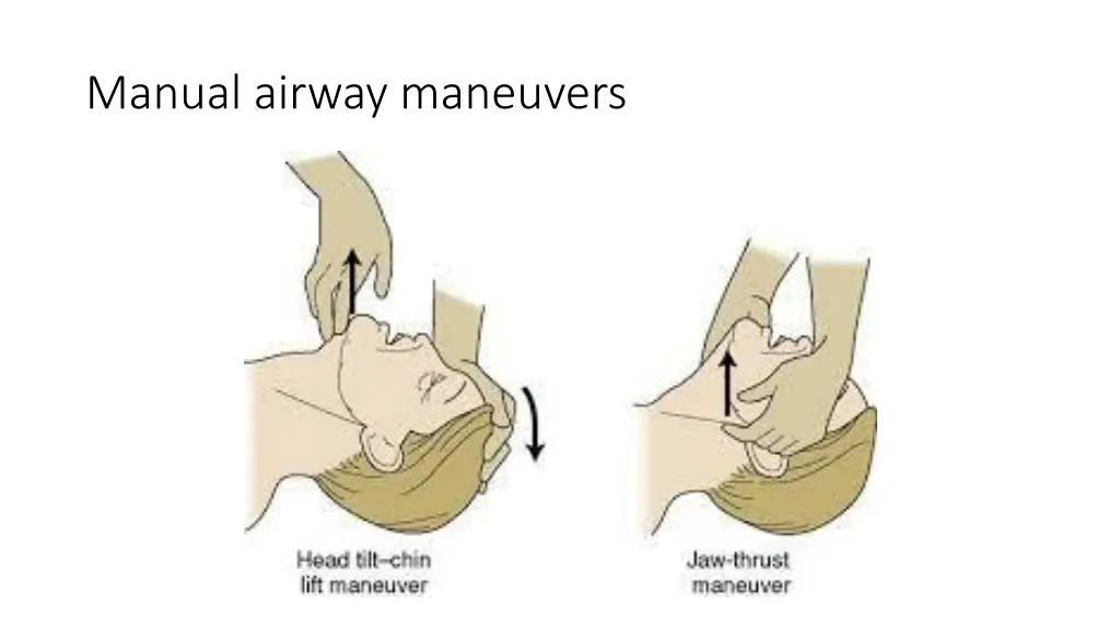 manual airway maneuvers