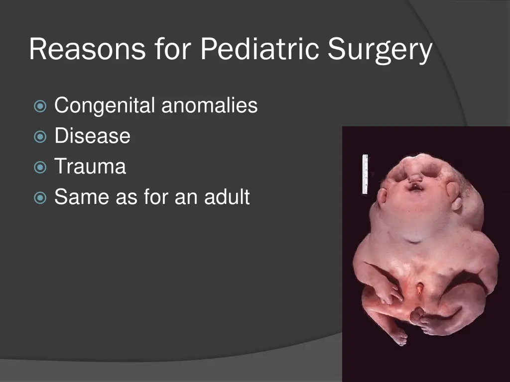 reasons for pediatric surgery