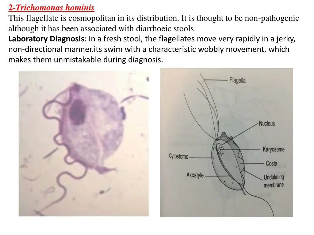 2 trichomonas hominis this flagellate