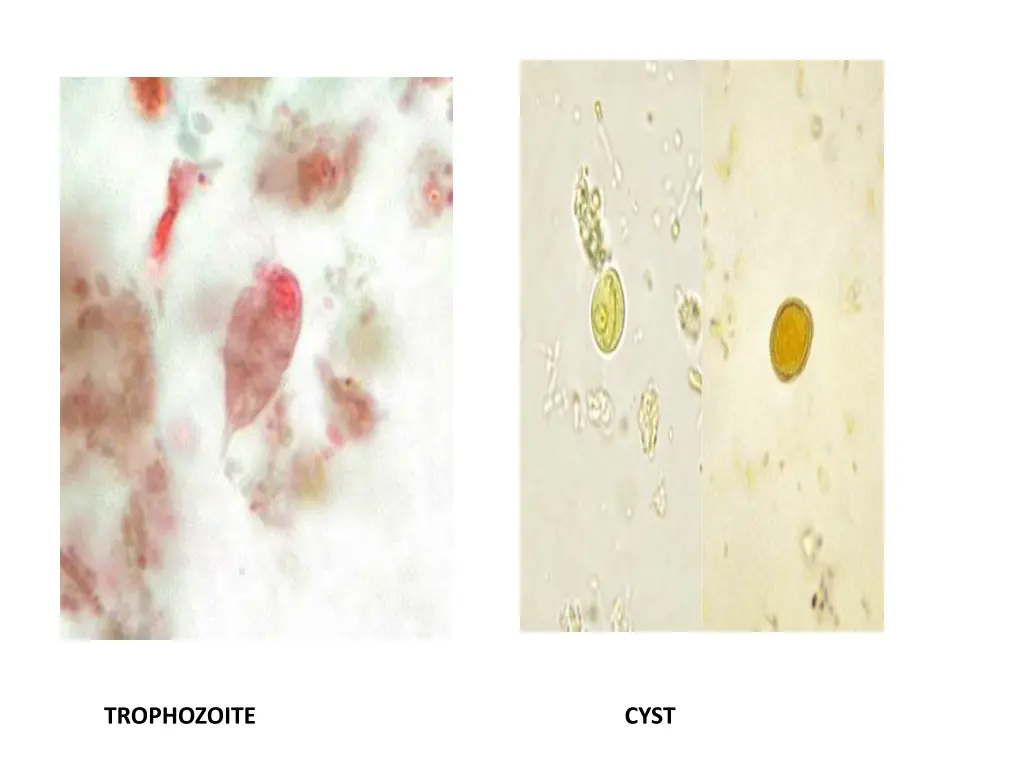 trophozoite 1