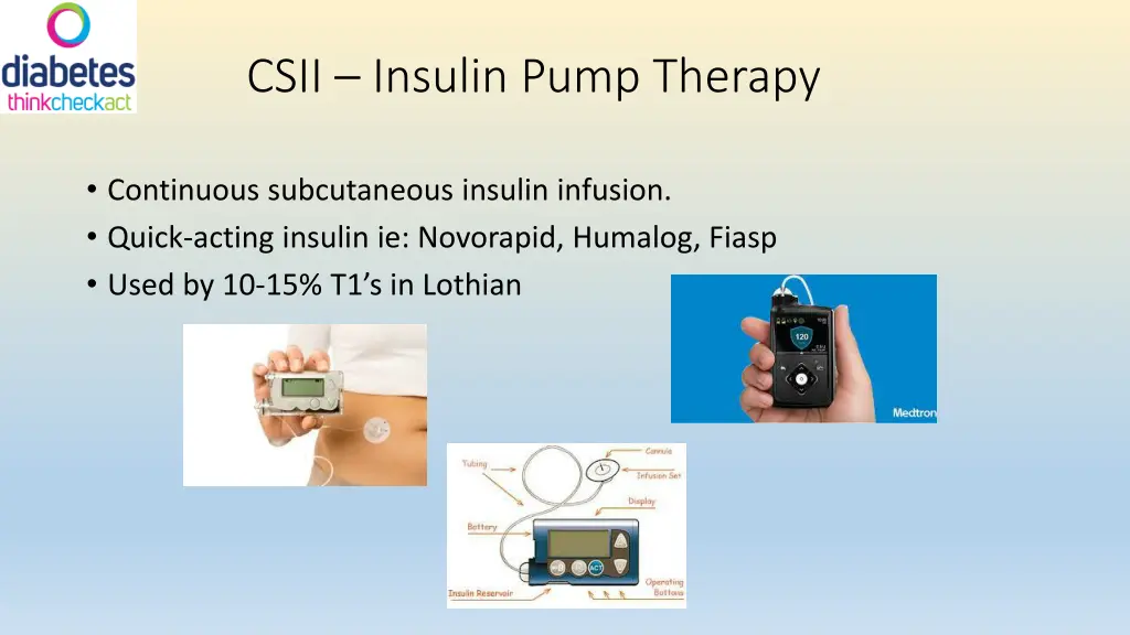 csii insulin pump therapy