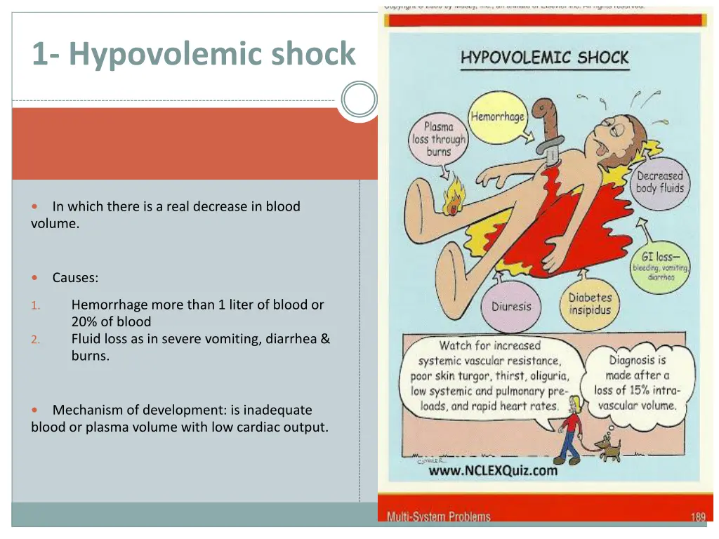 1 hypovolemic shock