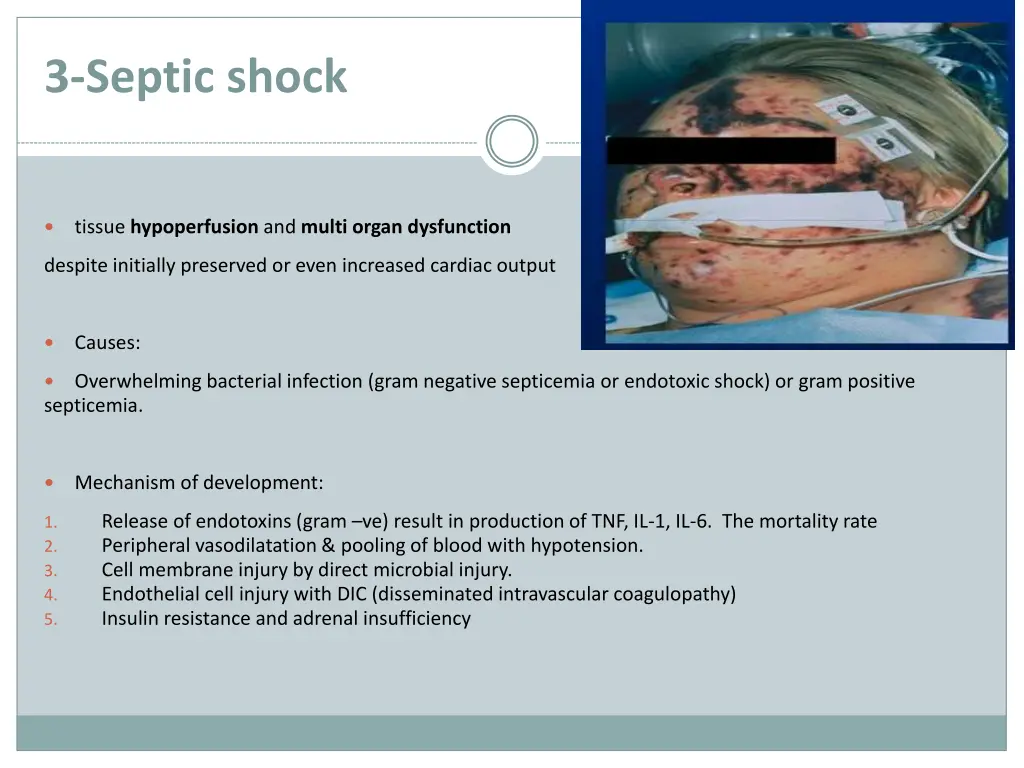 3 septic shock