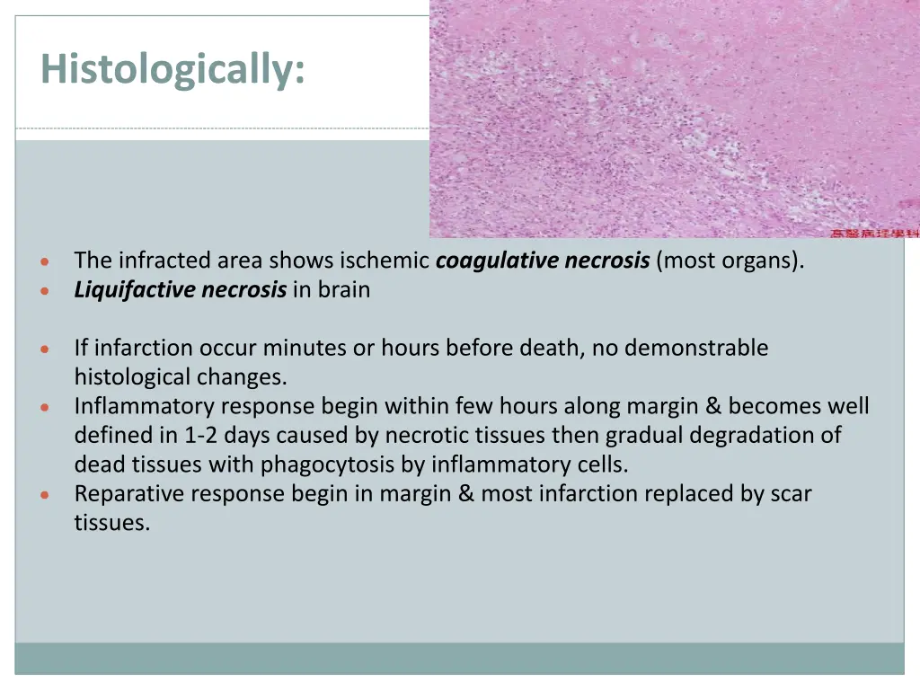 histologically