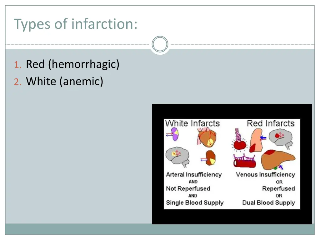 types of infarction