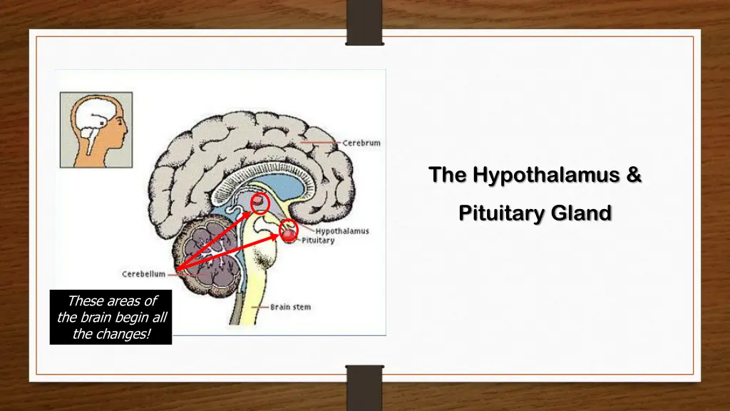 the hypothalamus