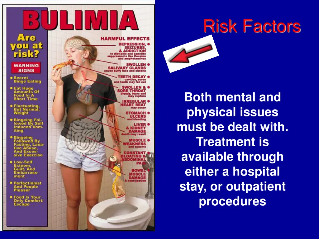 risk factors 1