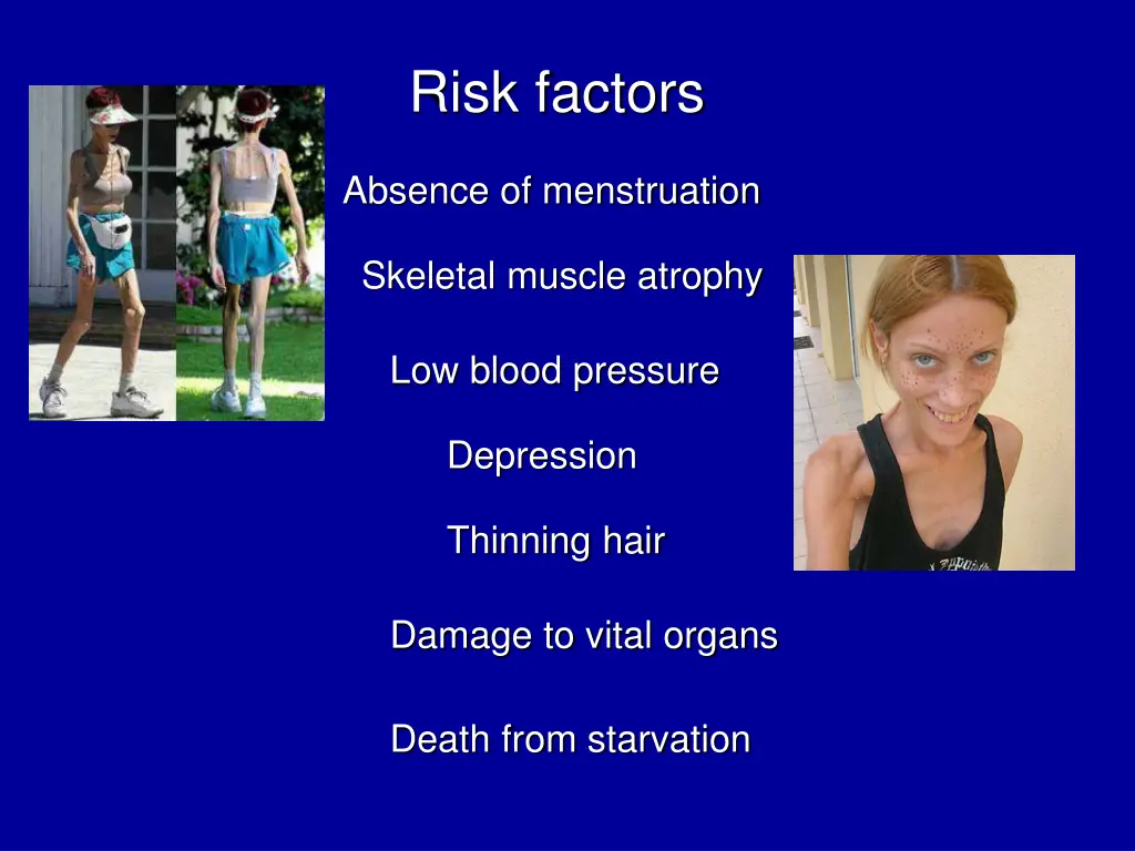 risk factors