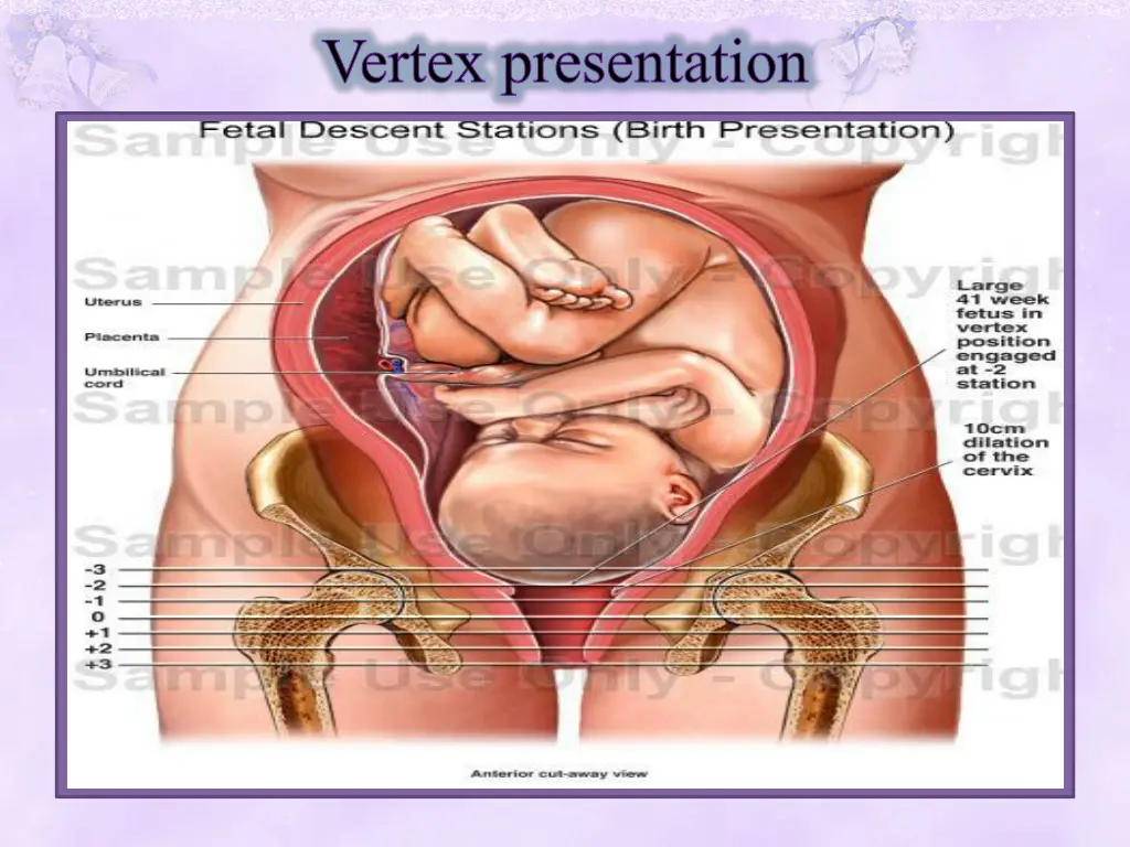 vertex presentation