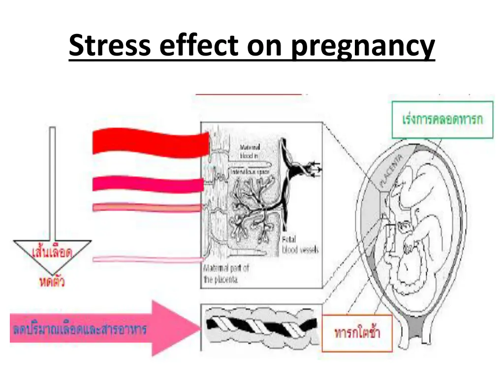 stress effect on pregnancy