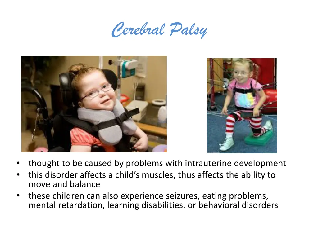 cerebral palsy