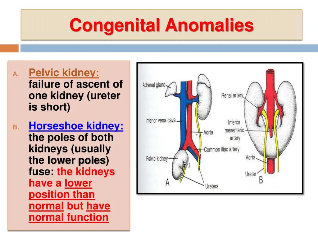 congenital anomalies