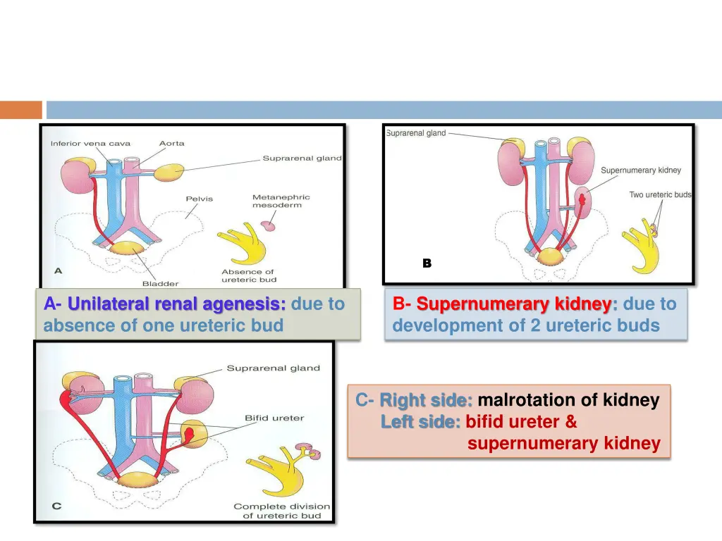 slide16