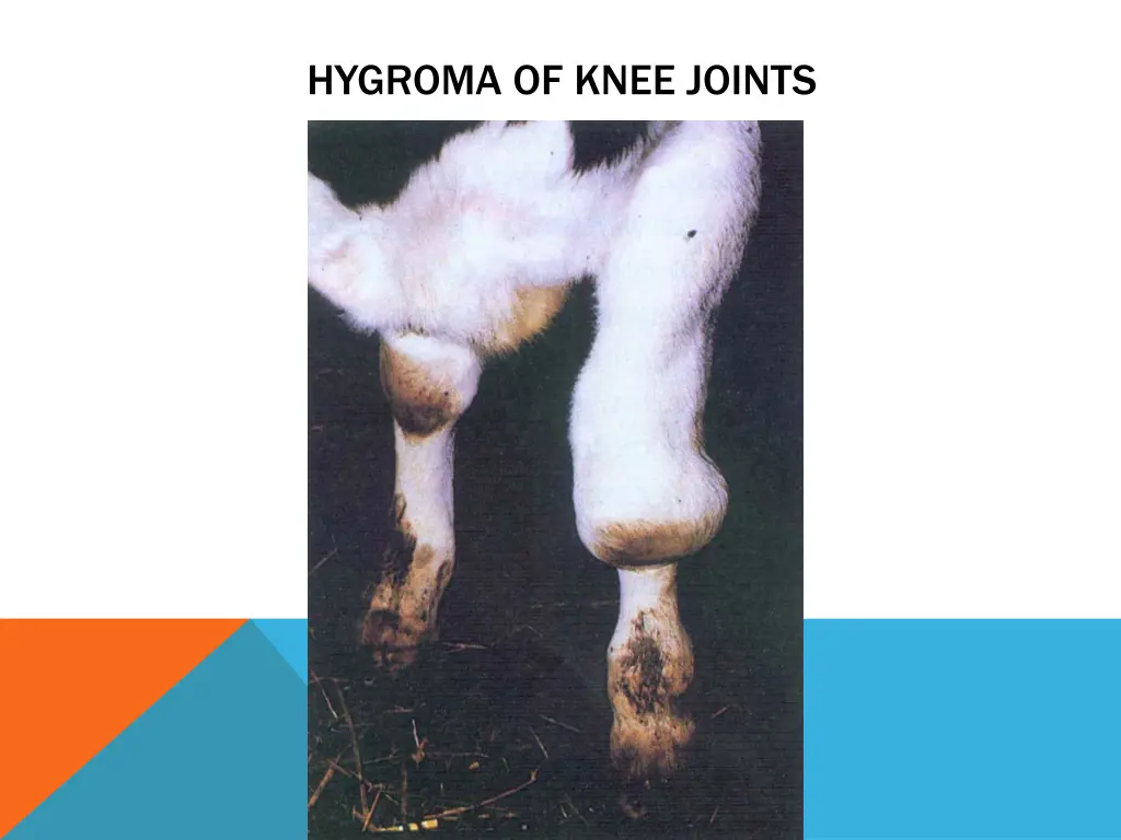 hygroma of knee joints