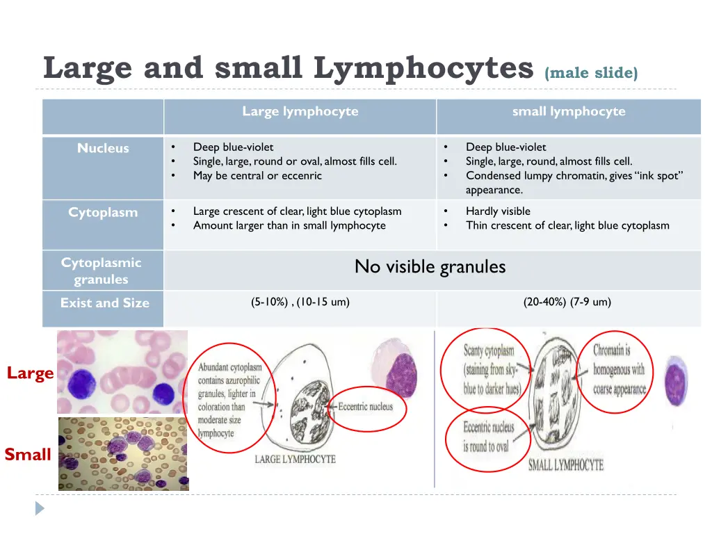 large and small lymphocytes male slide