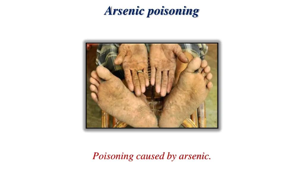 arsenic poisoning