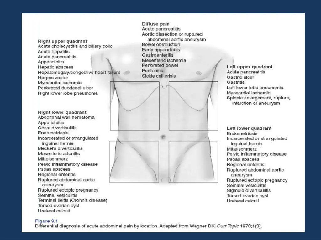 slide13