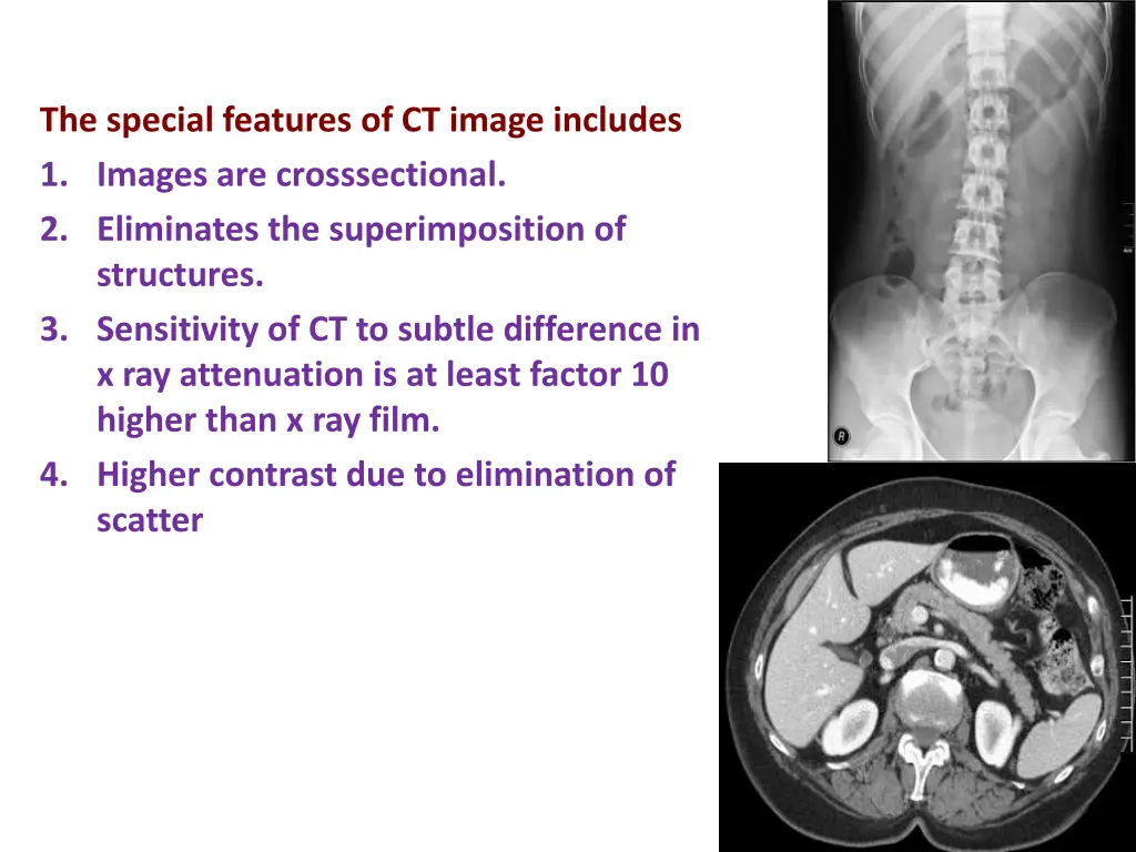 the special features of ct image includes