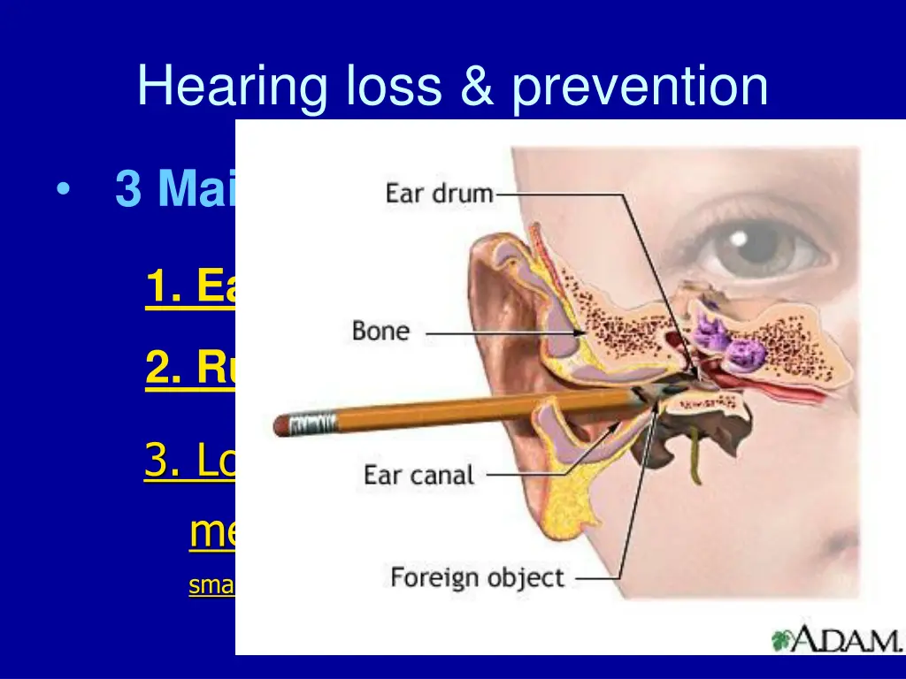 hearing loss prevention 1