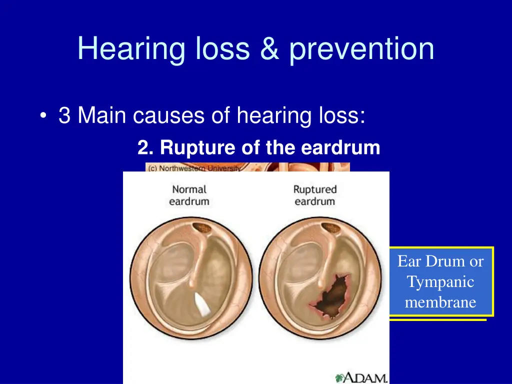 hearing loss prevention