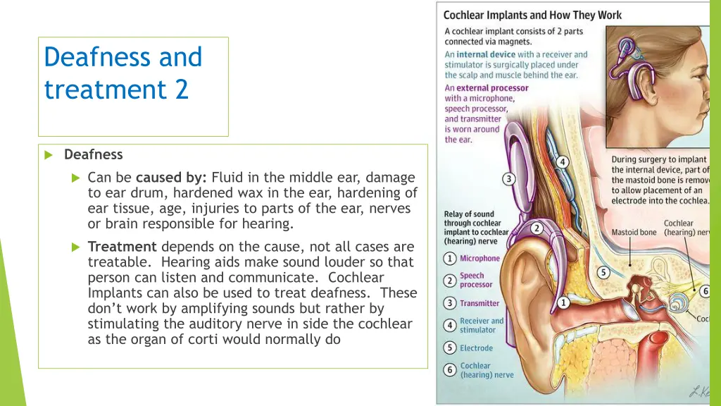 deafness and treatment 2