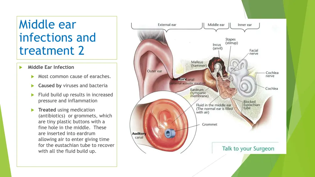 middle ear infections and treatment 2