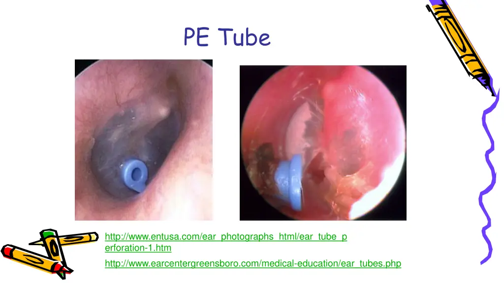 pe tube