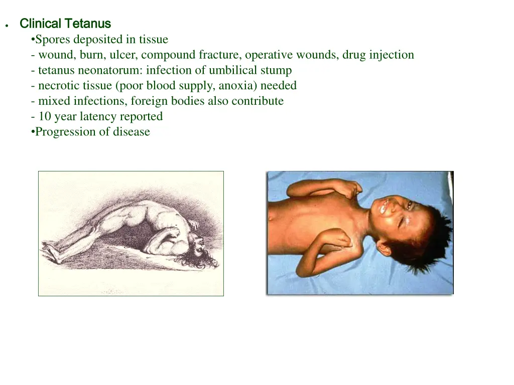 clinical tetanus clinical tetanus spores