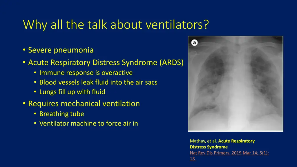 why all the talk about ventilators