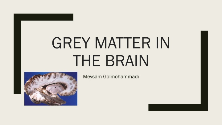 grey matter in the brain