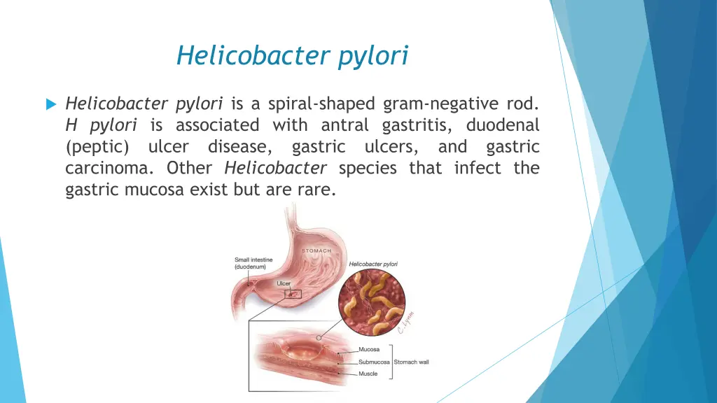 helicobacter pylori