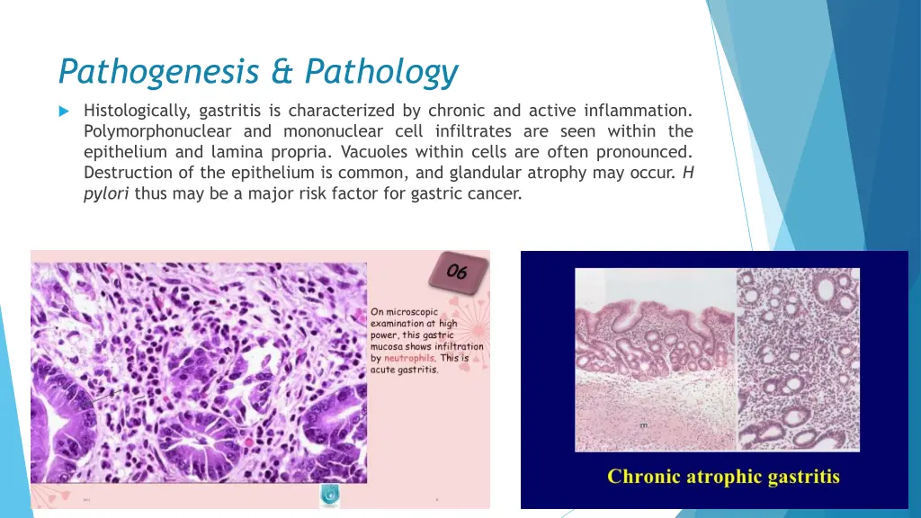 pathogenesis pathology 3