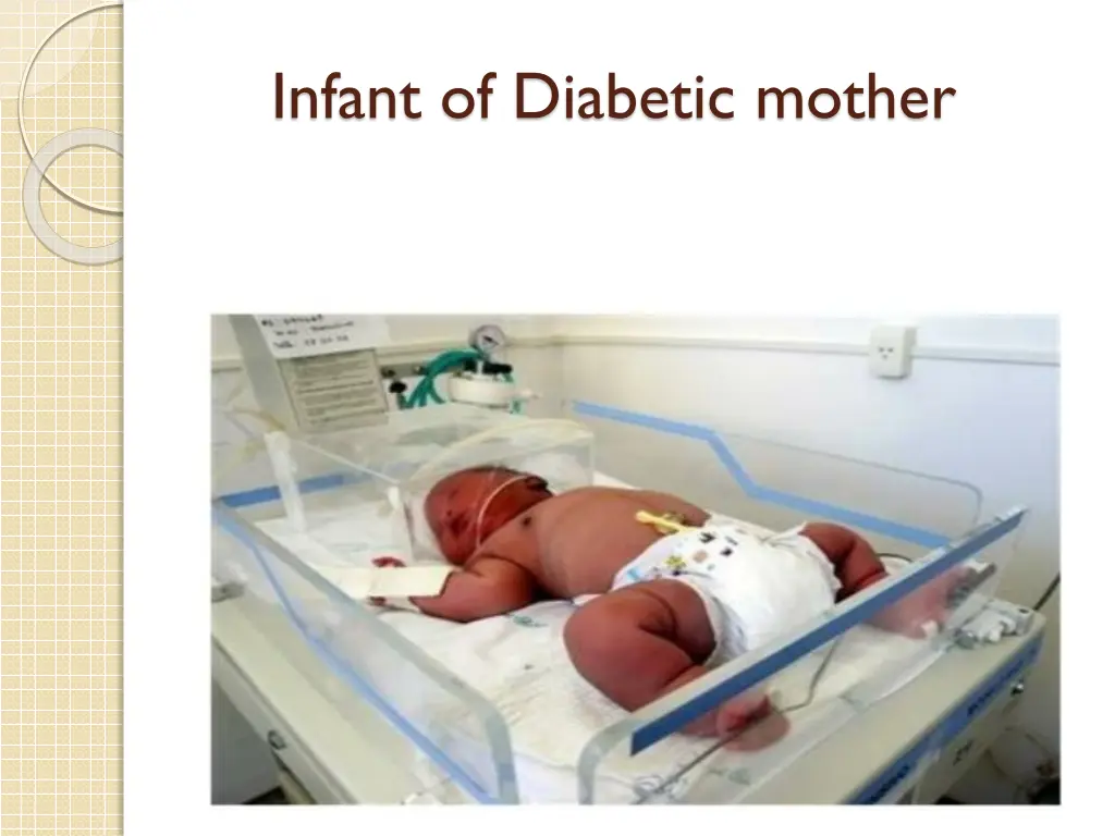 infant of diabetic mother