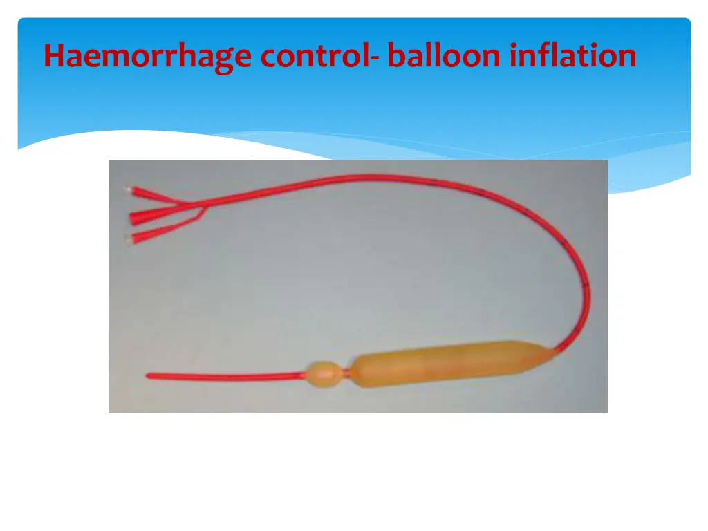 haemorrhage control balloon inflation 1