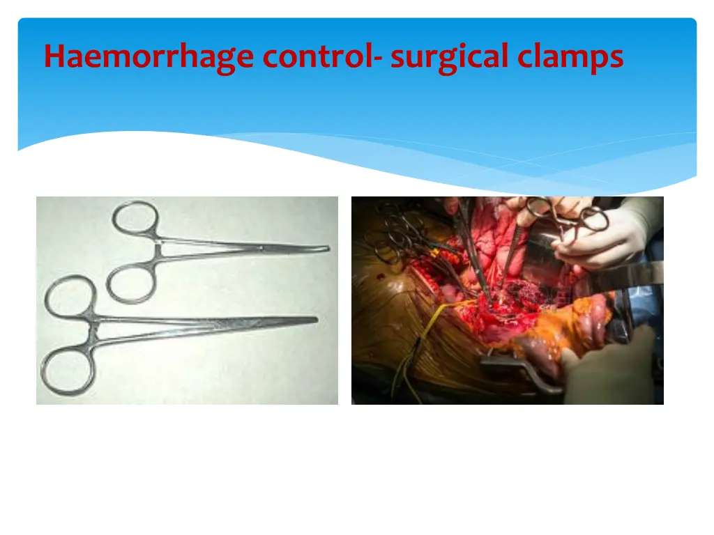 haemorrhage control surgical clamps