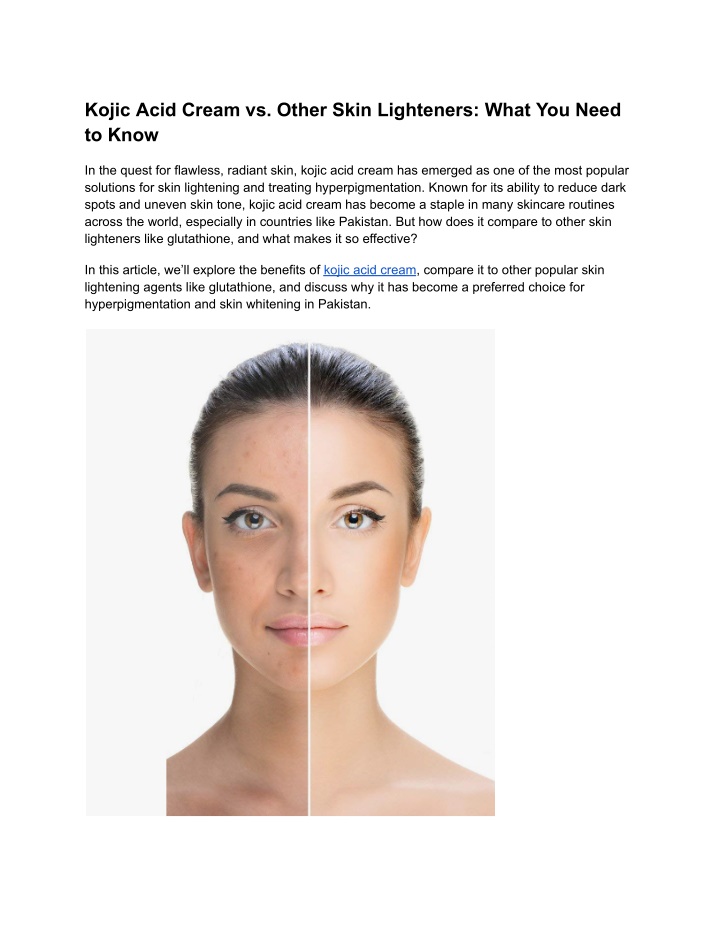 kojic acid cream vs other skin lighteners what