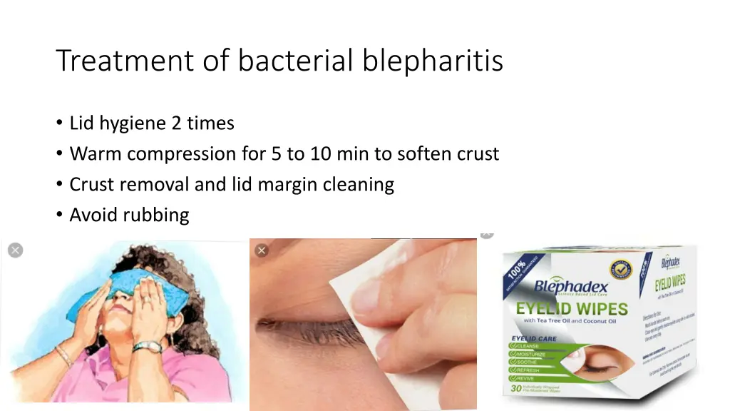 treatment of bacterial blepharitis